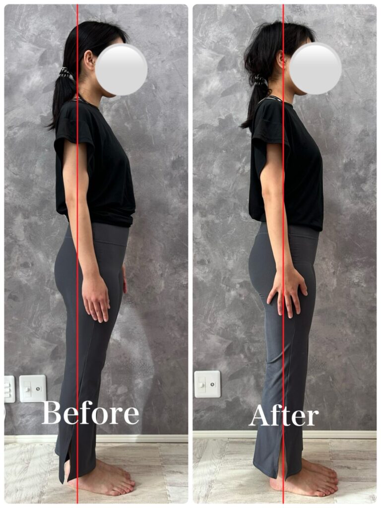 ビフォーアフター