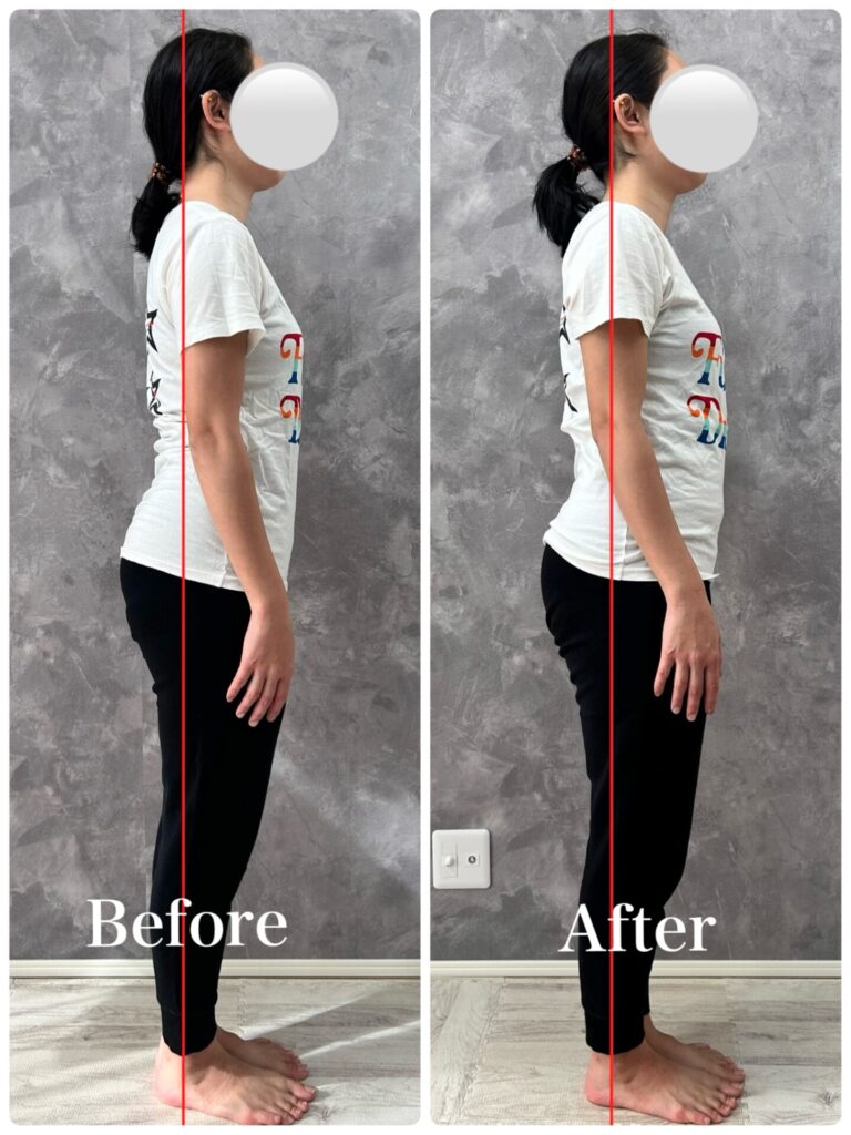 ビフォーアフター