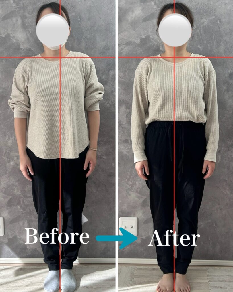 モニターさんのビフォーアフター①